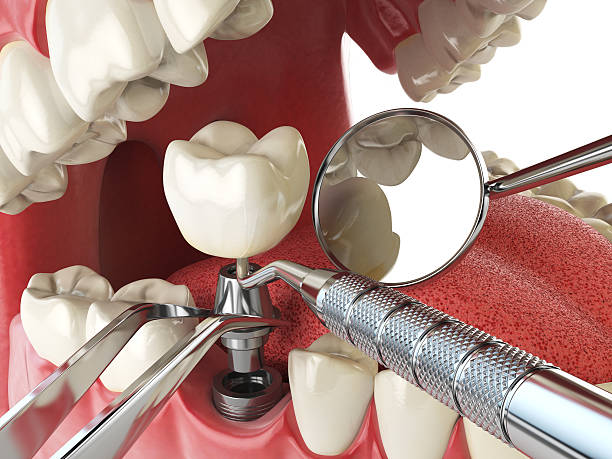 Best Emergency Tooth Extraction  in Royston, GA